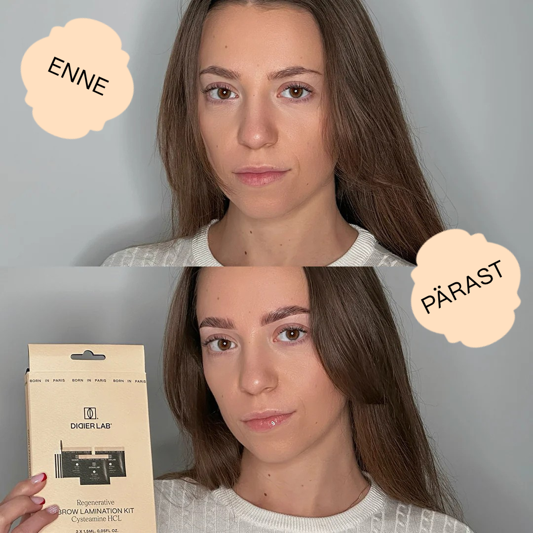 Regeneratiivne kulmude lamineerimiskomplekt, Didier Lab